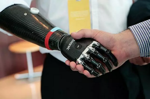 假肢價(jià)格注意事項(xiàng)(圖1) 假肢價(jià)格注意事項(xiàng)